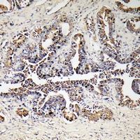 19 - Anti-ATP5D Antibody AP61207