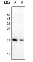 1 - Anti-ATP5D Antibody AP61207