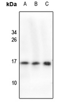 1 - Anti-Cystatin 11 Antibody AP61209