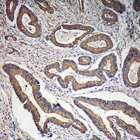 19 - Anti-DOCK2 Antibody AP61210