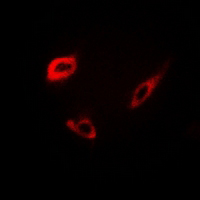 3 - Anti-INSL4 Antibody AP61213