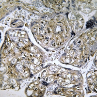19 - Anti-INSL4 Antibody AP61213