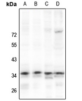 1 - Anti-NKX2-4 Antibody AP61215