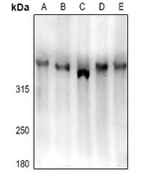 1 - Anti-LRP1B Antibody AP61216