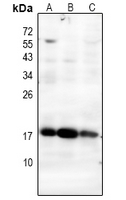 1 - Anti-MGST1 Antibody AP61218