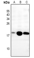 1 - Anti-MRPS36 Antibody AP61219