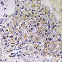 19 - Anti-NDUFS6 Antibody AP61220