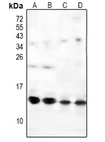 1 - Anti-NDUFS6 Antibody AP61220