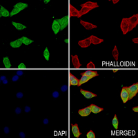3 - Anti-SSH3 Antibody AP61221