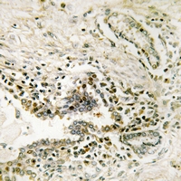 19 - Anti-SSH3 Antibody AP61221