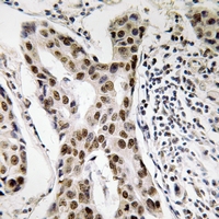 19 - Anti-PMS2 Antibody AP61222
