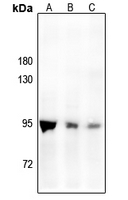 1 - Anti-PMS2 Antibody AP61222