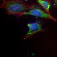 3 - Anti-ULK1 Antibody AP61223