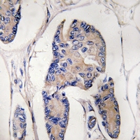 19 - Anti-ULK1 Antibody AP61223