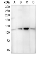 1 - Anti-ULK1 Antibody AP61223