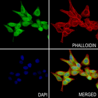 3 - Anti-ZNF691 Antibody AP61226