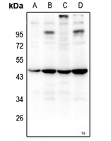 1 - Anti-ZNF691 Antibody AP61226