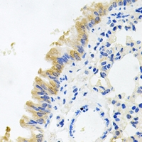 19 - Anti-CD322 Antibody AP61227