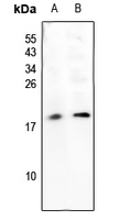 1 - Anti-SUMO2 Antibody AP61228