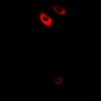 3 - Anti-Frizzled 1 Antibody AP61230