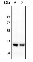 1 - Anti-Kappa Opioid Receptor Antibody AP61232
