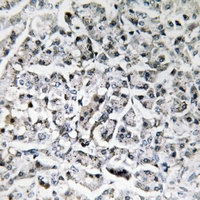 19 - Anti-IL-11 Antibody AP61233