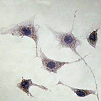 15 - Anti-NEFH Antibody AP61237