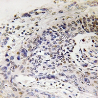 19 - Anti-NEFH Antibody AP61237