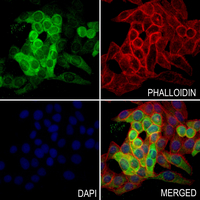 3 - Anti-PAI1 Antibody AP61239