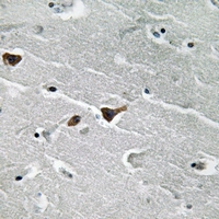 19 - Anti-PAI1 Antibody AP61239