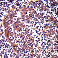 19 - Anti-RAMP3 Antibody AP61241