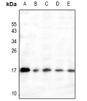 1 - Anti-RAMP3 Antibody AP61241