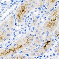 19 - Anti-CD11b Antibody AP61243