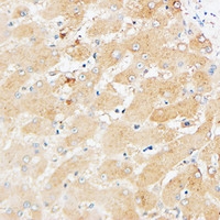 19 - Anti-CD109 Antibody AP61245