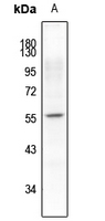 1 - Anti-Synaptotagmin (Phospho-S309/306) Antibody AP61247