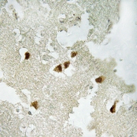 19 - Anti-GRLF1 (Phospho-Y1105) Antibody AP61248