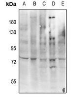 1 - Anti-c-RAF (Phospho-Y341) Antibody AP61249