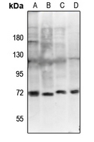 1 - Anti-ZAP70 (Phospho-Y292) Antibody AP61251