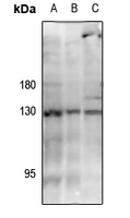 1 - Anti-JAK3 (Phospho-Y785) Antibody AP61253