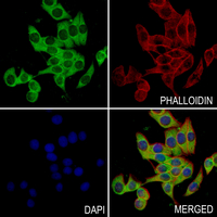 3 - Anti-GEF H1 (Phospho-S885) Antibody AP61254