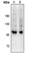 1 - Anti-GEF H1 (Phospho-S885) Antibody AP61254