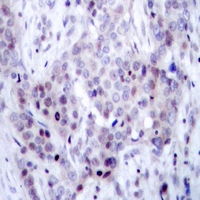 19 - Anti-NF-kappaB p100 (Phospho-S869) Antibody AP61255