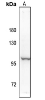 1 - Anti-NF-kappaB p100 (Phospho-S869) Antibody AP61255