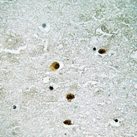 19 - Anti-HSP27 (Phospho-S78) Antibody AP61256