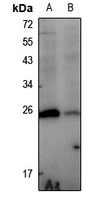 1 - Anti-HSP27 (Phospho-S78) Antibody AP61256