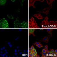 3 - Anti-GLUR1 (Phospho-S863) Antibody AP61257