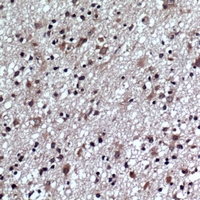 19 - Anti-GLUR1 (Phospho-S863) Antibody AP61257