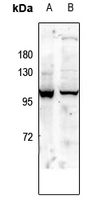 1 - Anti-GLUR1 (Phospho-S863) Antibody AP61257