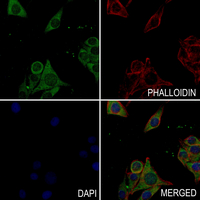 3 - Anti-ASK1 (Phospho-T838) Antibody AP61258