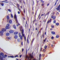 19 - Anti-ASK1 (Phospho-T838) Antibody AP61258